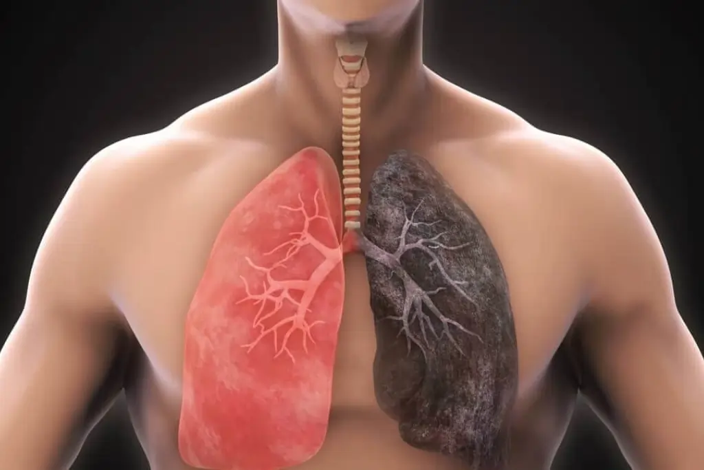 COPD treatment by lung specialist in Vadodara